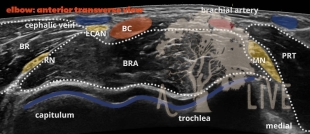 elbow: anterior transverse view