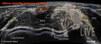 elbow: anterior transverse view