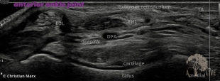 anterior ankle joint