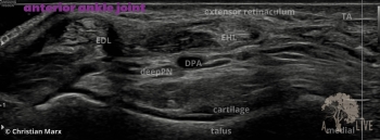 anterior ankle joint