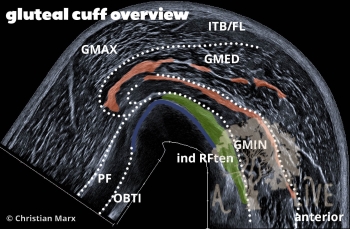gluteal cuff overview